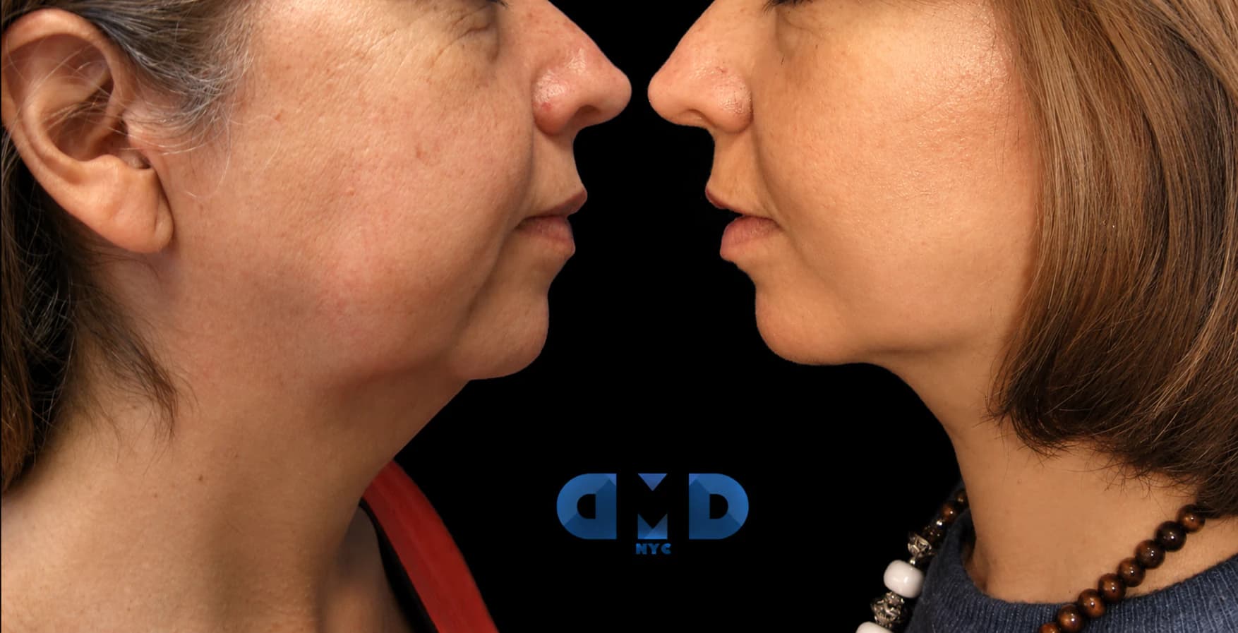 The Lookbook in New York City - Dagan MD Full-color facial rejuvenation patient photography
