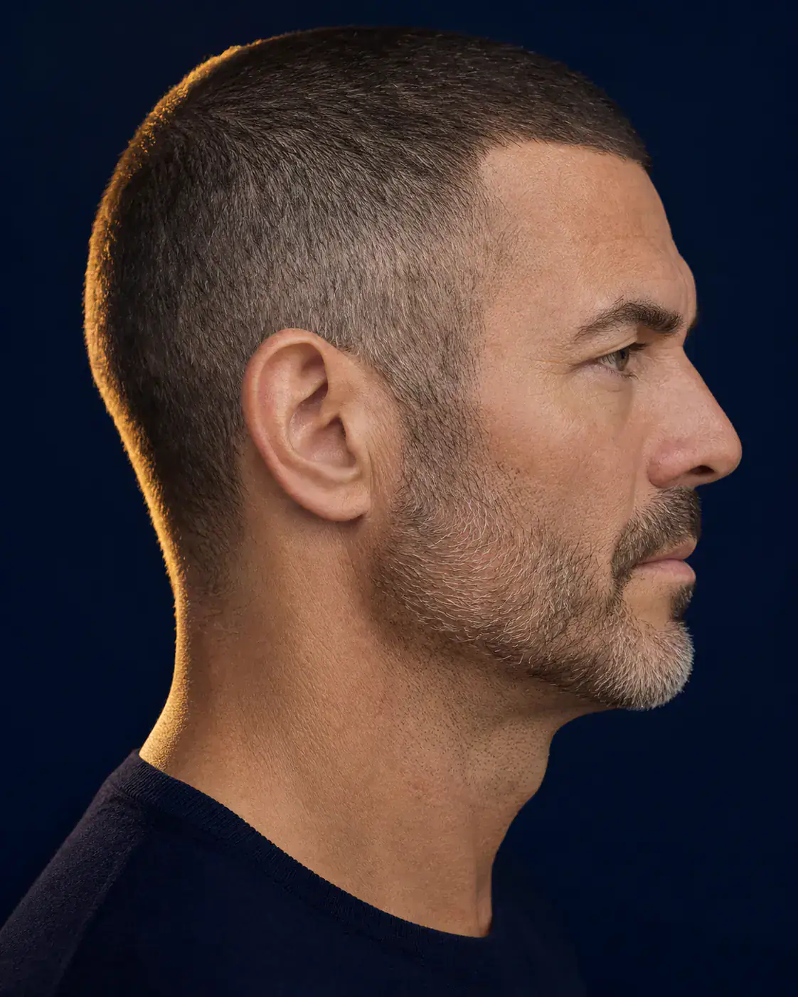 Earlobe Reduction in New York City - Dagan MD Full-color editorial image illustrating earlobe reduction consultation goals; not an actual patient result