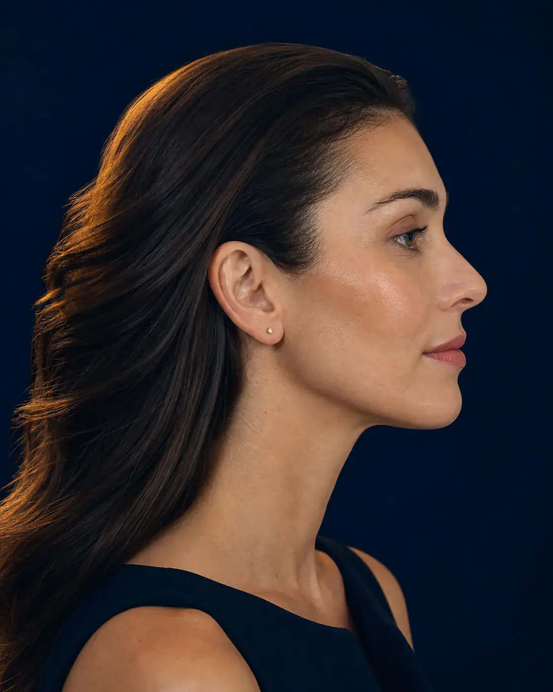 Earlobe Repair in New York City - Dagan MD Full-color editorial image illustrating earlobe repair consultation goals; not an actual patient result