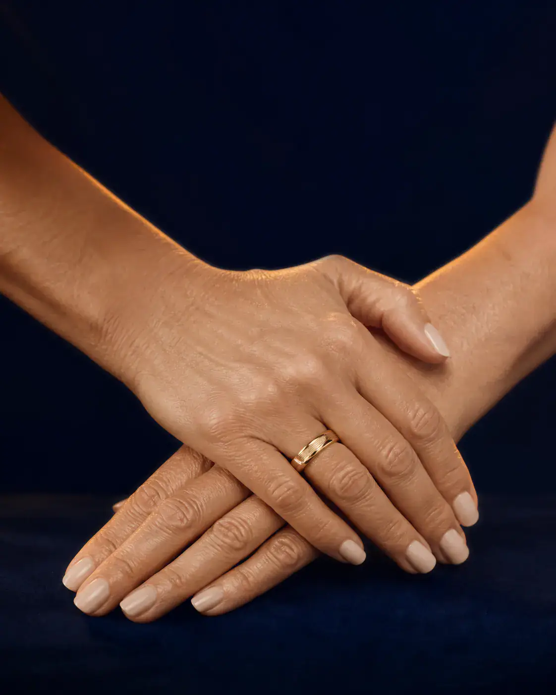 Editorial image illustrating Radiesse hand rejuvenation consultation goals; not an actual patient result