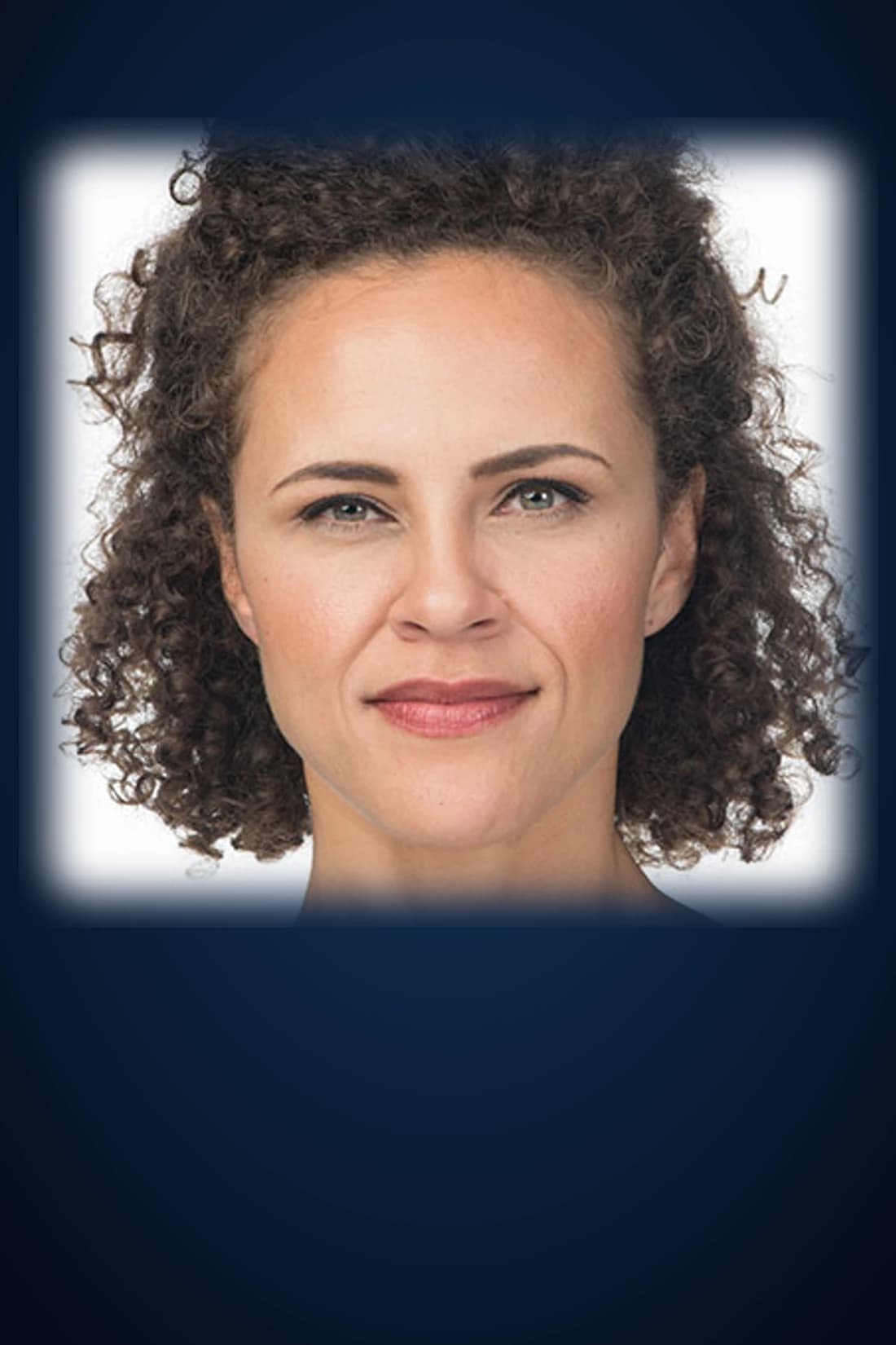 After BOTOX® Cosmetic treatment photograph for Dagan MD patient case 1 in New York City. Individual results vary.