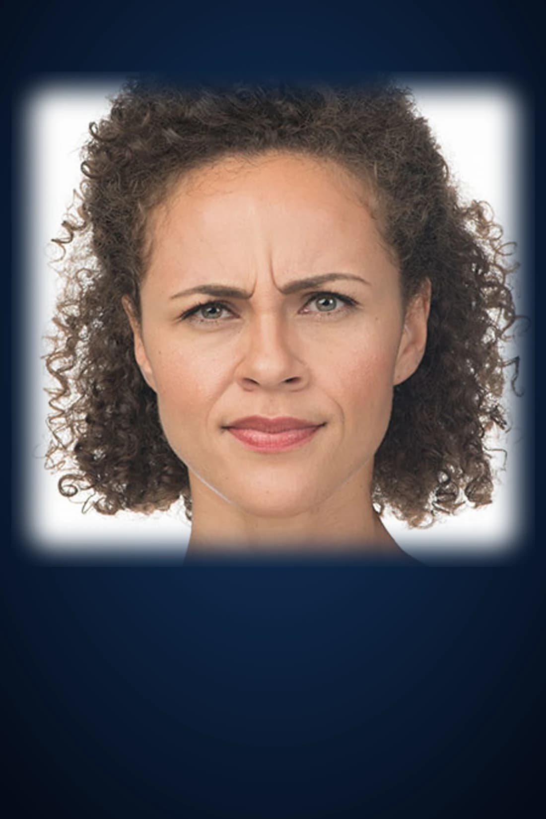 Before BOTOX® Cosmetic treatment photograph for Dagan MD patient case 1 in New York City. Individual results vary.