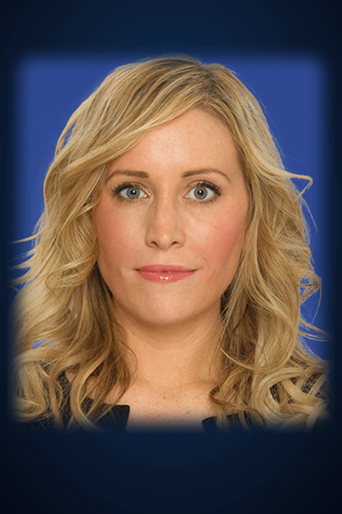 After JUVÉDERM® dermal filler treatment photograph from the Dagan MD patient gallery in New York City. Individual results vary.