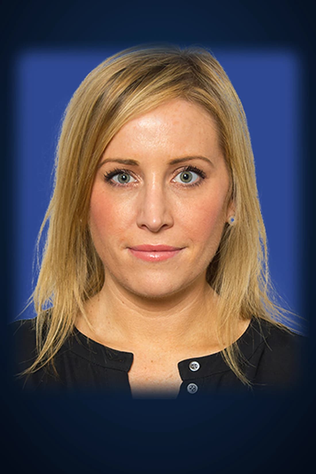 Before JUVÉDERM® dermal filler treatment photograph from the Dagan MD patient gallery in New York City. Individual results vary.
