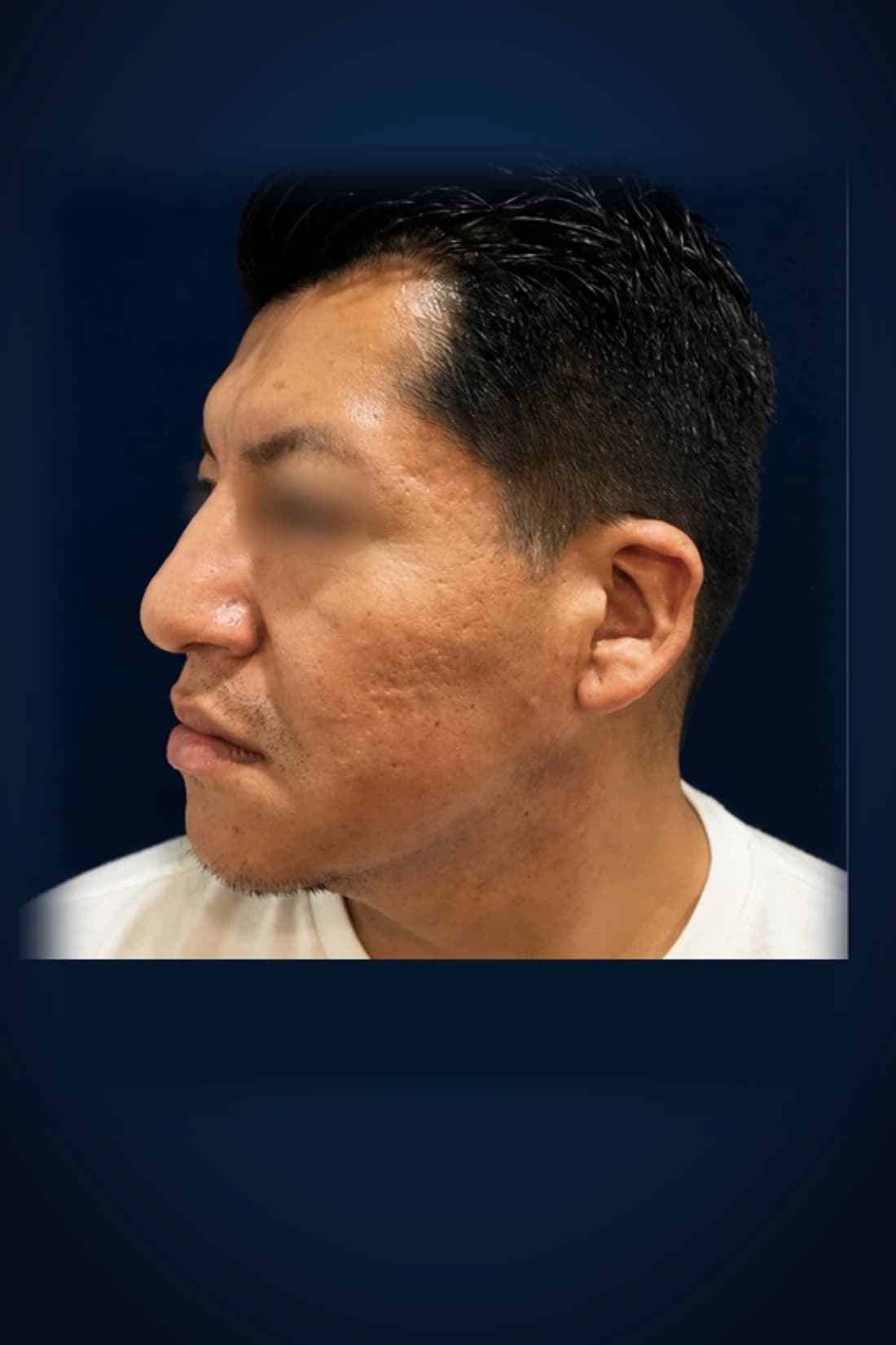 After treatment photograph for Procedure classification pending at Dagan MD in New York City. Individual results vary.